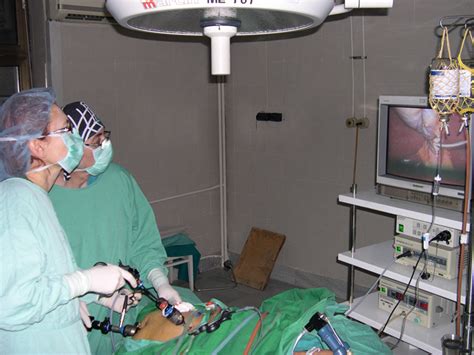 ендоскопска хирургия на разширени вени на хранопровода